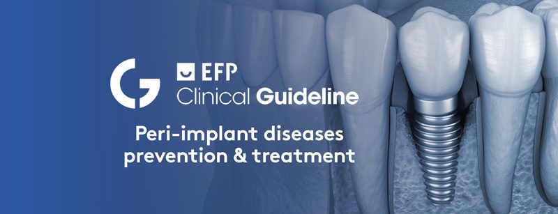 Read more about the article EFP Guideline på forebygging av peri-implantitt