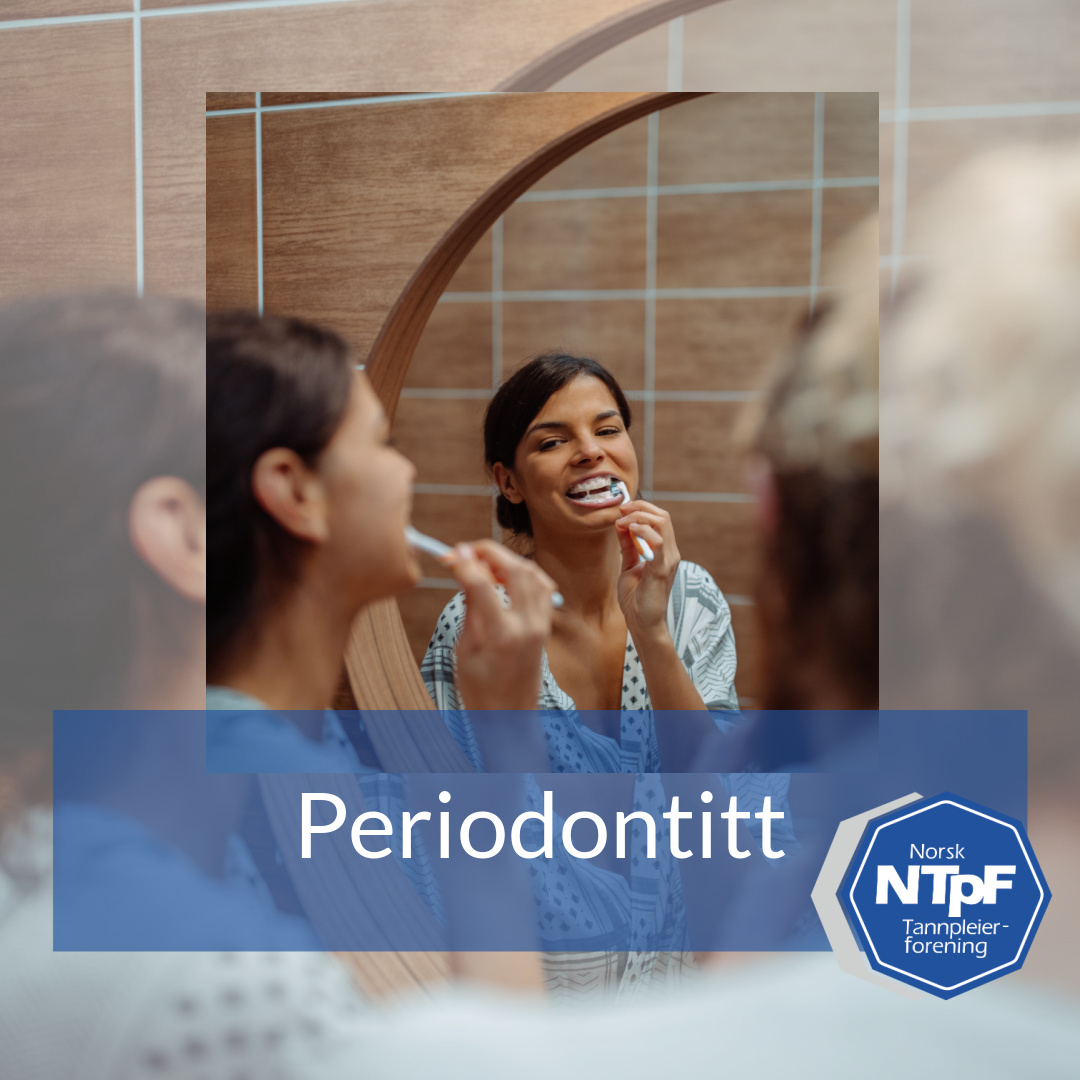 Read more about the article Mikronæringsstoffer i forebygging og behandling av periodontitt