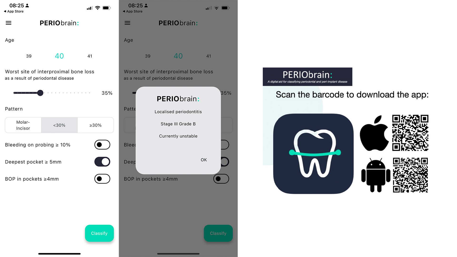 Read more about the article Perio brain -app